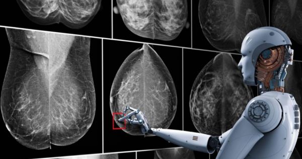 AI,会让放射科医生下岗吗?