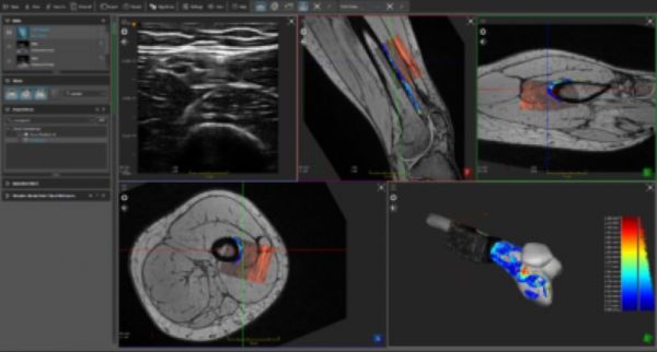 AI,会让放射科医生下岗吗?