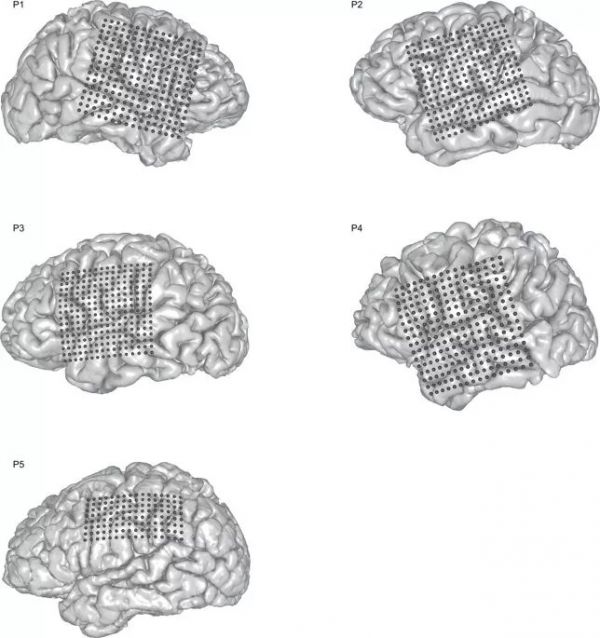 Nature重磅:华裔科学家成功解码脑电波,AI直接从大脑中合成语音