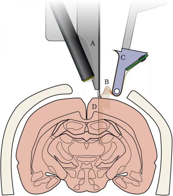 Nature重磅:华裔科学家成功解码脑电波,AI直接从大脑中合成语音