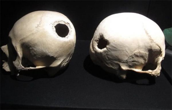 从Neuralink到FB:硅谷“读心术”哪家强?