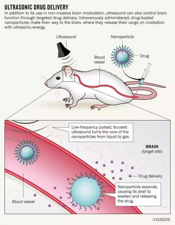 为侵入性脑机接口瑟瑟发抖?别怕,大脑可以被“声控”了