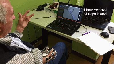 意念加AI算法「复原」每个手指,智能义肢登上Nature子刊封面