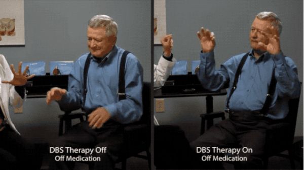 如果科技能够让你变“超脑”，你愿意尝试吗？