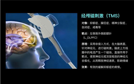 如果科技能够让你变“超脑”，你愿意尝试吗？