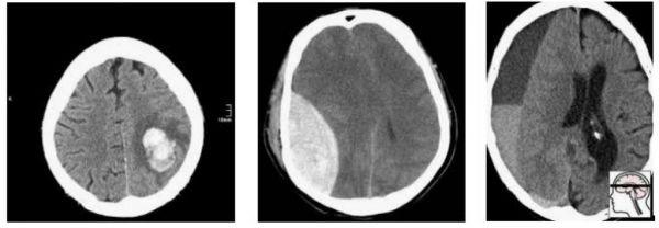 AI竞赛没有意义:模型根本没用,冠军全凭运气?