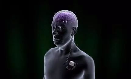 专访斯坦福大学神经科学家:脑机接口只是看上去很美?