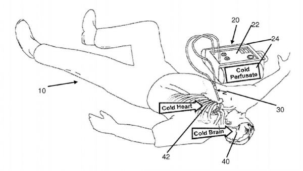 起死回生:美国科学家首次让人类进入“假死状态”,换取手术时间