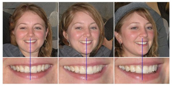 英伟达发布最强图像生成器StyleGAN2，生成图像逼真到吓人