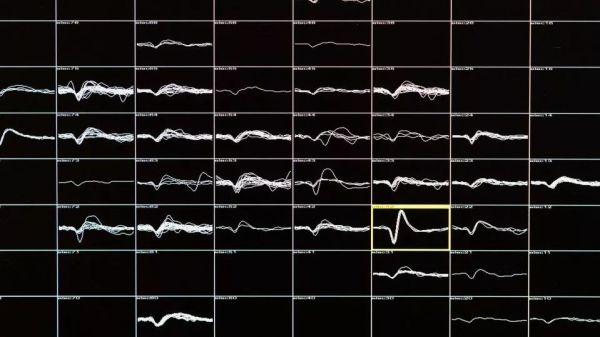 在大脑中植入100根电极后,失明16年的患者重见光明