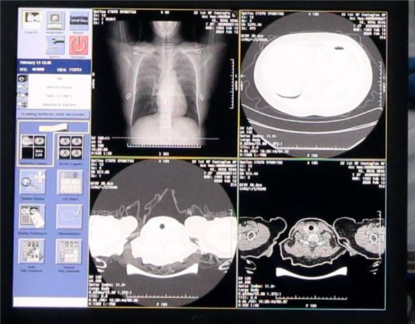 检测新冠病毒,AI功能终于找到真正价值?
