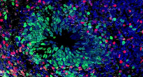 “人造大脑”道德吗?