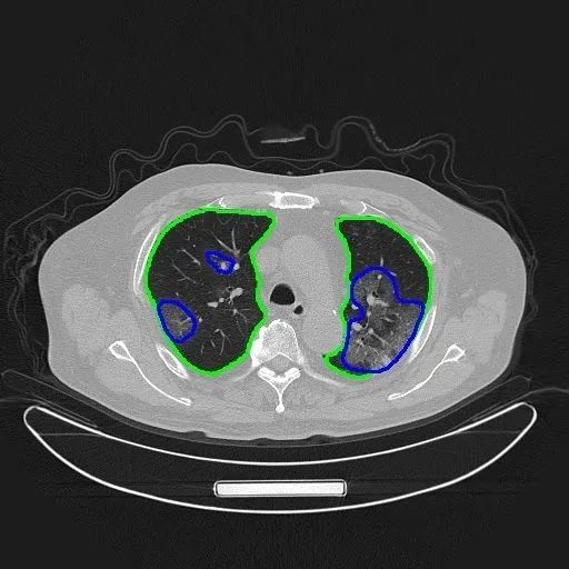 邬贺铨院士点评大数据抗疫:价值初显,但还可以更好