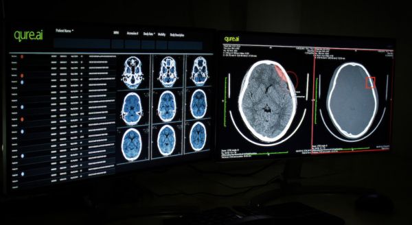 胸部和头部扫描结果将更加准确?医疗 AI 新锐公司「Qure.ai」获 1600 万美元融资