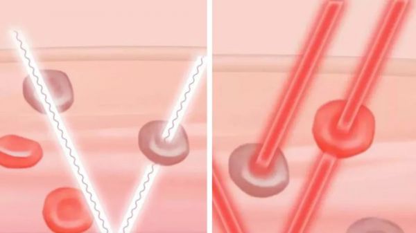 新一代 Apple Watch 将增加血氧检测功能,血氧监测缘何呼声这么高?