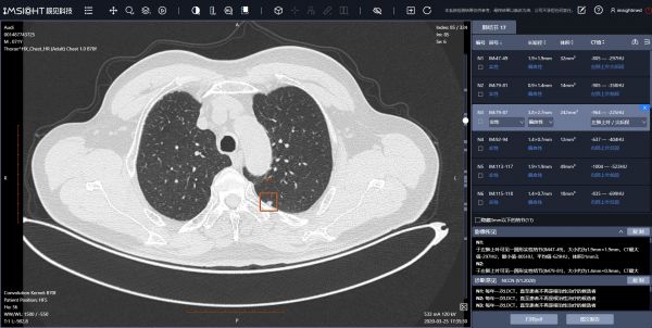 10秒读一张CT,2年内成熟病种的AI辅诊会普遍应用 | 超级观点