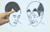 美国的“人造头皮”，会成为秃头新救星？