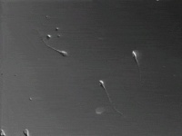 被误解了300年的精子游动方式