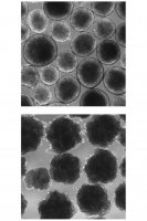 人类用尼安德特人基因培养出古人类的“迷你大脑”