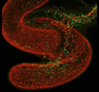 保持积极心理状态，真的能让生病好得更快