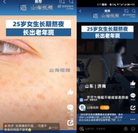 我，25岁，陷入“衰老焦虑”