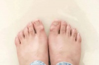 杨紫琼同款病，每5个人里就有1个