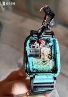 智能手表爆燃！10岁儿童被二度烧伤！