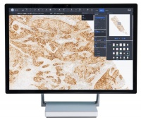 罗氏诊断携手迪英加科技，借力AI助推病理诊断智慧化转型