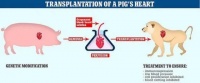 基因改造69次，全球首例人类活体移植猪肾成功了