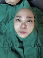 排队整容的老年人，养活县城美容院