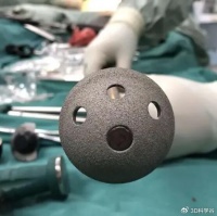 增材制造典型应用场景—医用钛合金骨科植入物的定制生产