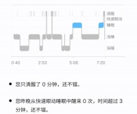好险，幸亏我没举着智能戒指去求婚