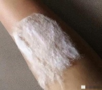 一辈子只会治一种病的绝活