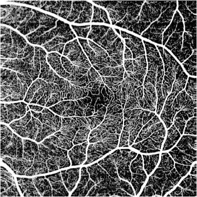 融资合伙人入围项目 | 眼科扫频OCT产品进口替代进行时，「图湃影像」认为一二级医院是主要战场