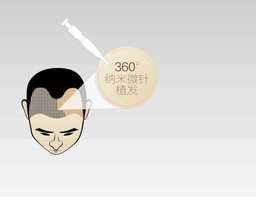 更名「大麦」,“头部玩家”「科发源」意在全球植发市场