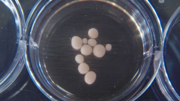 迷你“人造大脑”初具雏形，未来面临伦理问题