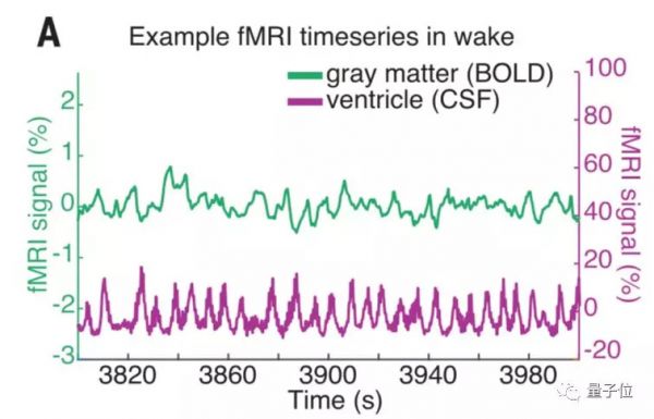 熬夜变傻有科学依据,人类睡觉时会被“洗脑”,科学家首次拍下全程