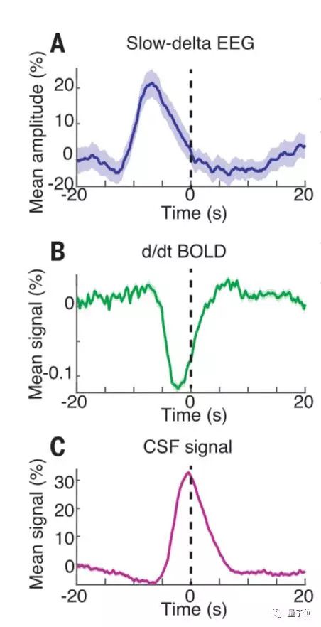 熬夜变傻有科学依据,人类睡觉时会被“洗脑”,科学家首次拍下全程
