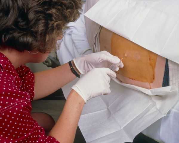 国产阿尔茨海默病新药获批，但攻克AD之路依旧漫长