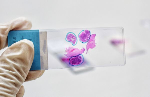 研发非侵入性癌症筛查技术，新加坡基因测序医学公司「Lucence」 获2000万美元A轮融资