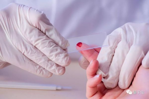 1滴血，2小时，验13种癌症，精度99%！日本东芝新技术引热议