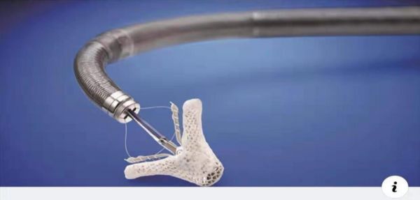 演员高以翔不幸离世,监测心脏健康状态,这些“新科技”或许能帮上忙