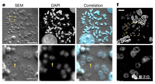 Nature:最强癌基因找到了,居然不在染色体上