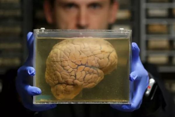 泡在培养皿中的人造大脑，居然偷偷向外界发出脑电波