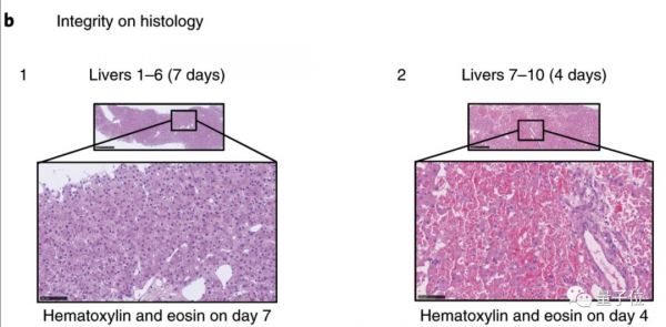 肝脏离开人体还能活7天！这是最新技术突破，其间还可以修复损伤