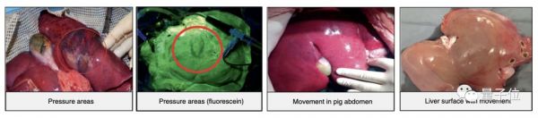 肝脏离开人体还能活7天！这是最新技术突破，其间还可以修复损伤