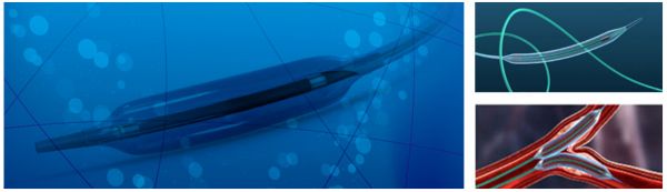 专注心血管高值耗材，「恒升医疗」完成4000万元Pre-A轮融资