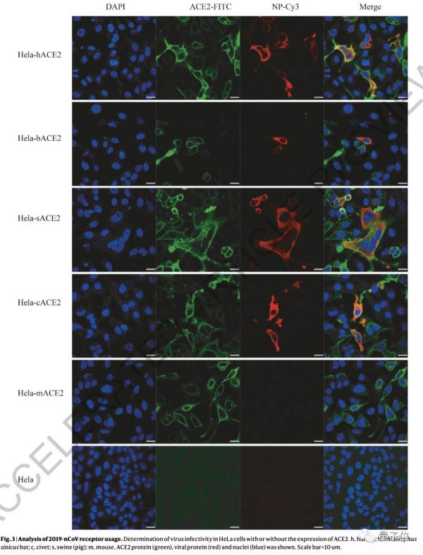 Nature首次、连发2篇新冠病毒论文:确认病毒进入细胞路径