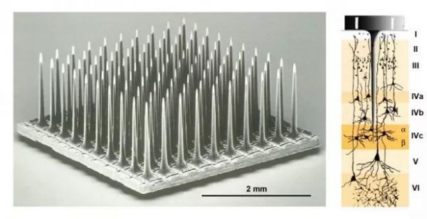 脑机接口迎来新突破？失明患者在大脑中植入电极后重见光明