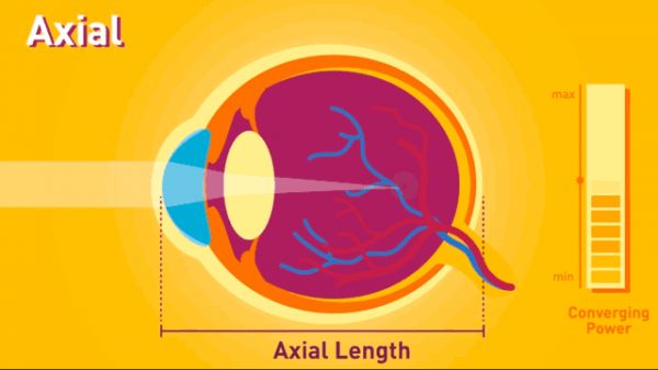 现在的学生，还有不近视的吗？